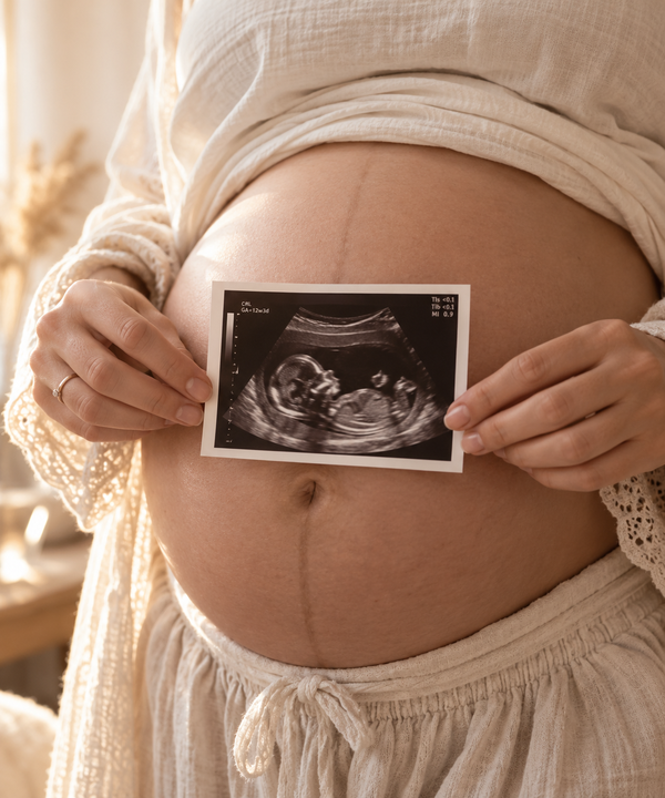 Pourquoi consulter une doula ou accompagnante p&eacute;rinatale?